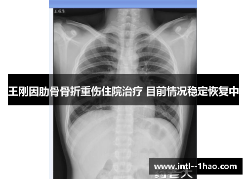 王刚因肋骨骨折重伤住院治疗 目前情况稳定恢复中